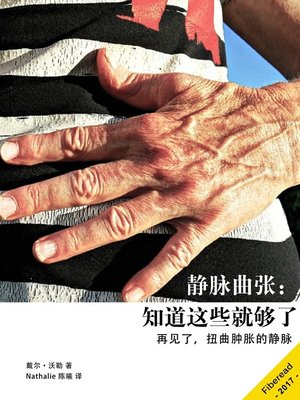 cover image of 静脉曲张